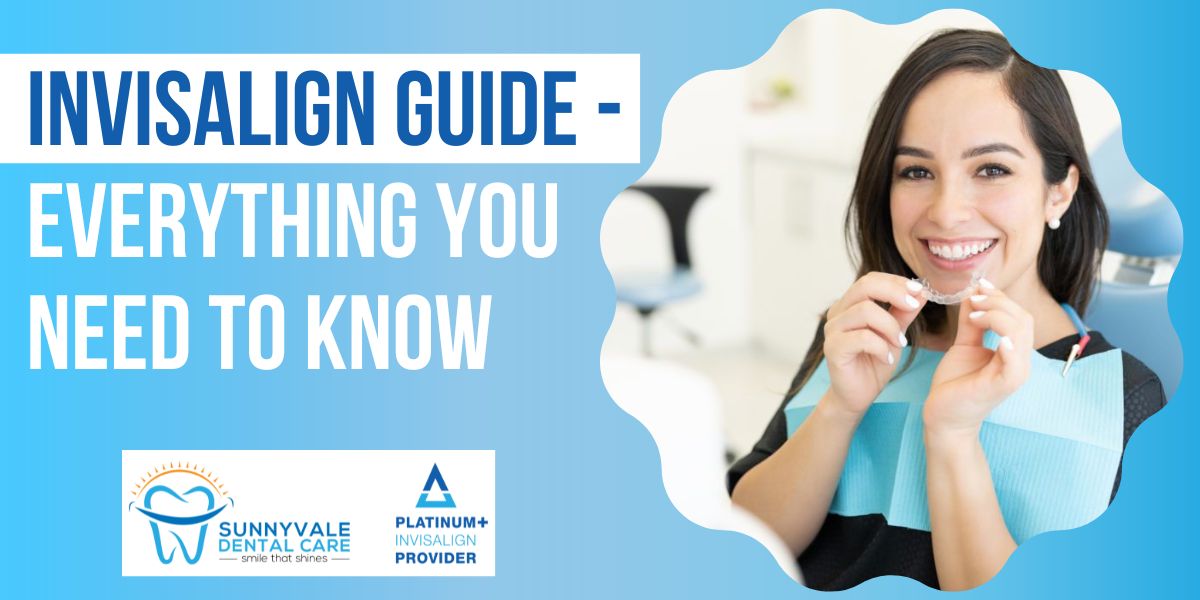 Invisalign guide - everything you need to know