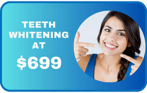 sunnyvale teeth whitening offer-min