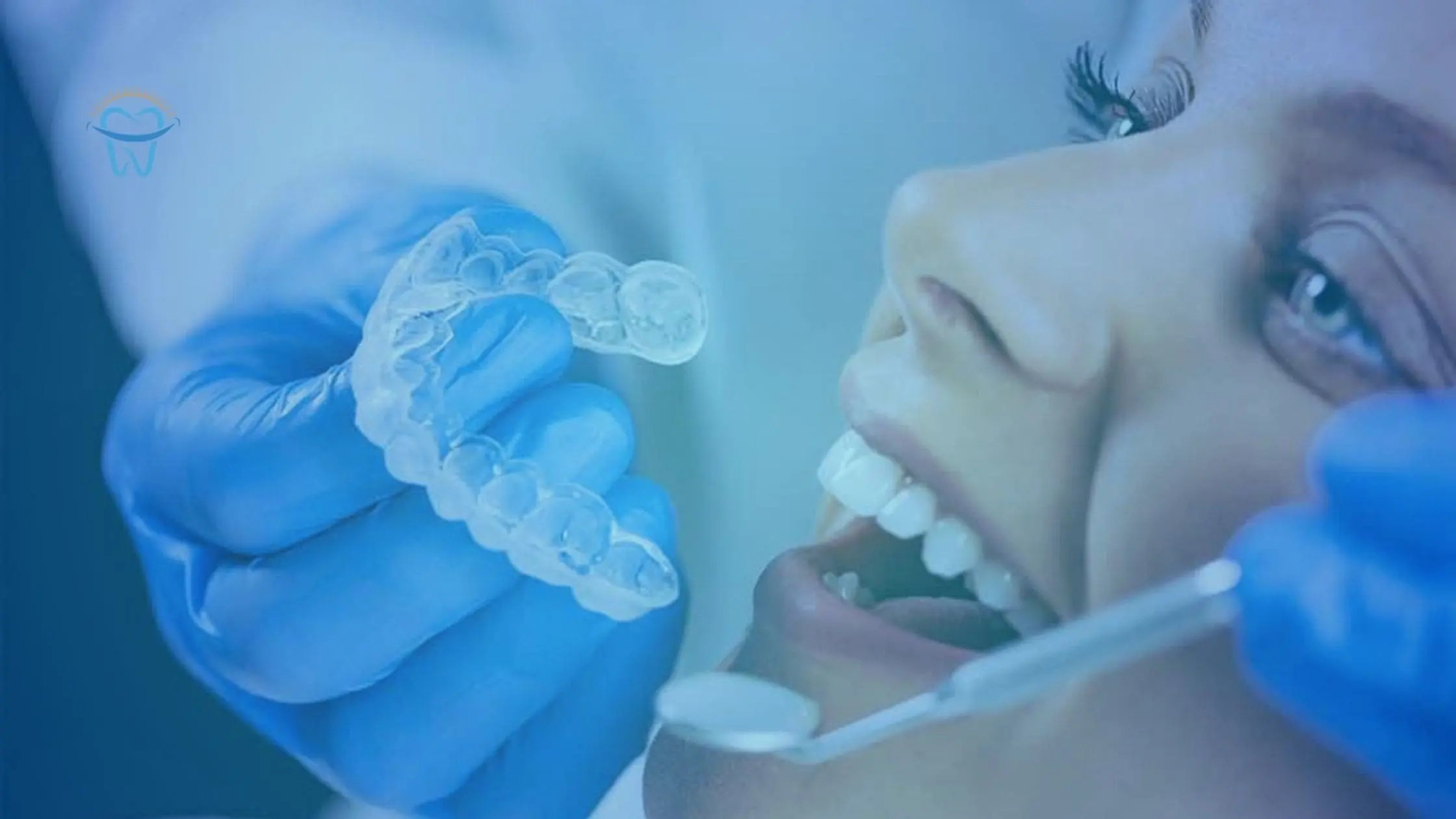 How-to-select-right-Invisalign-dentist-in-Sunnyvale