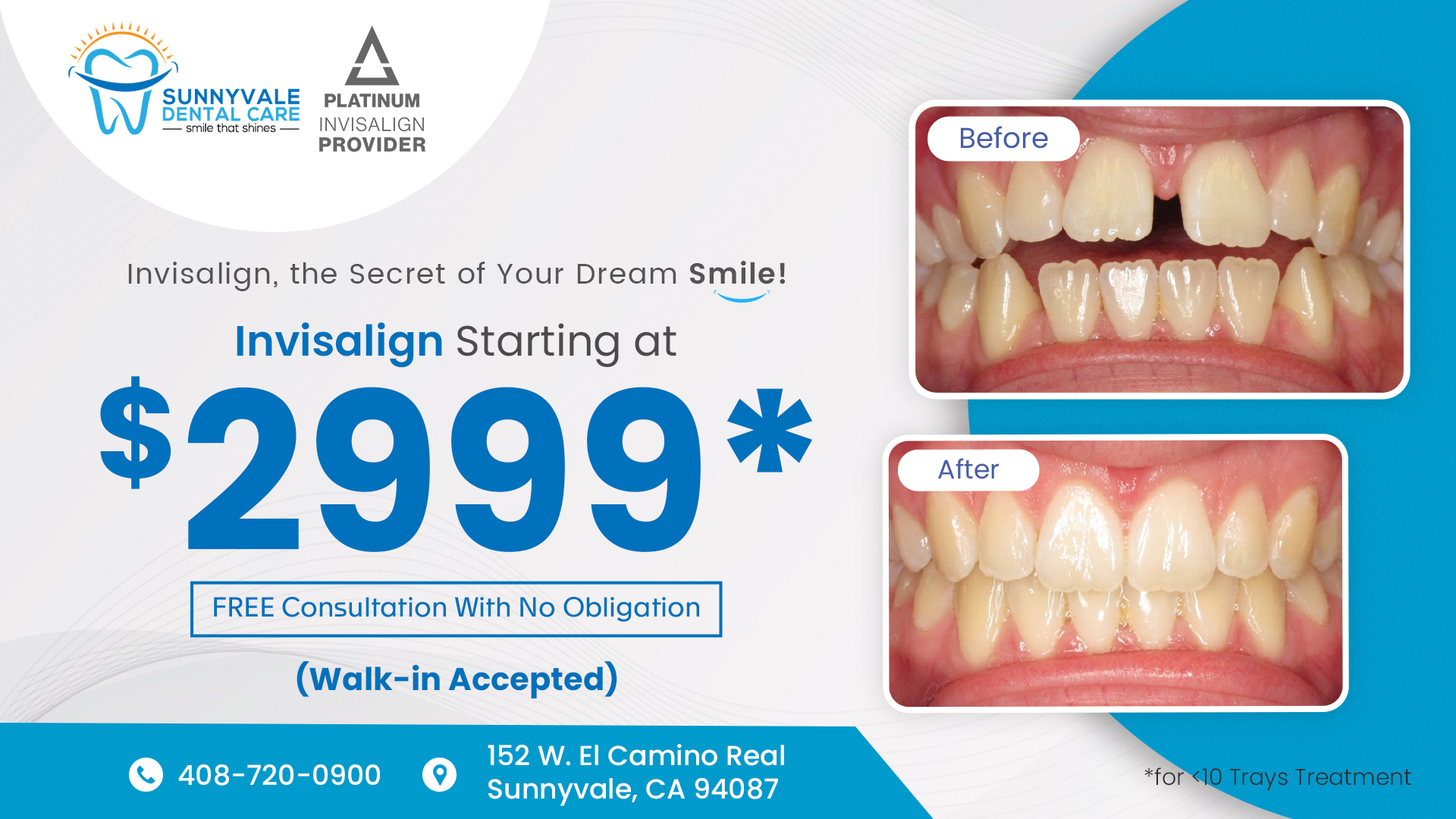 About Invisalign® Orthodontics Sunnyvale Dentist Sunnyvale Dental Care