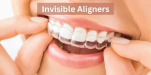 Invisible Aligners as Teeth Gap (Diastema) Treatments