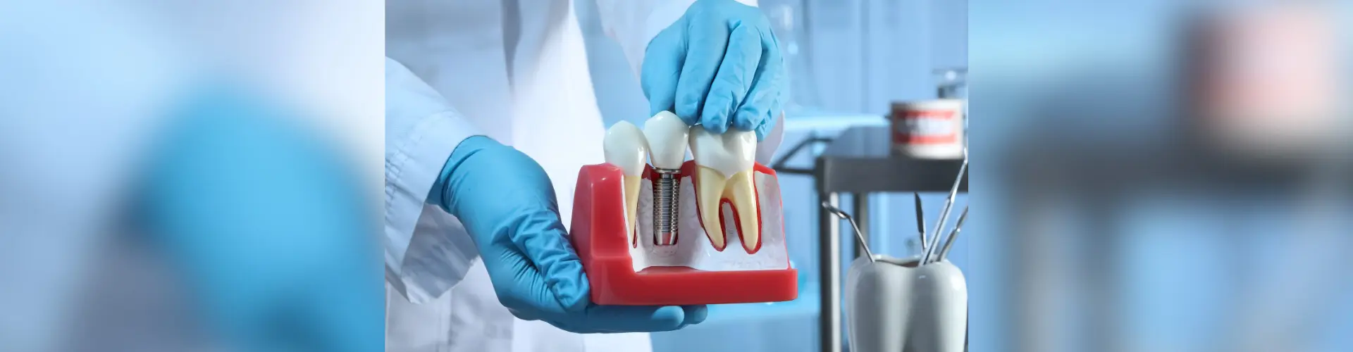 Sunnyvale dental implant cost