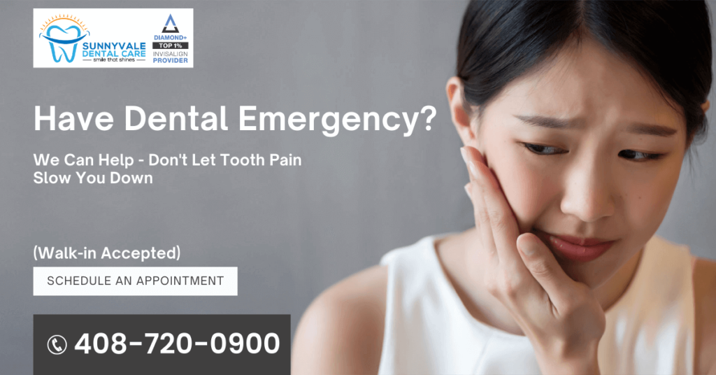 Have Dental Emergency in Sunnyvale