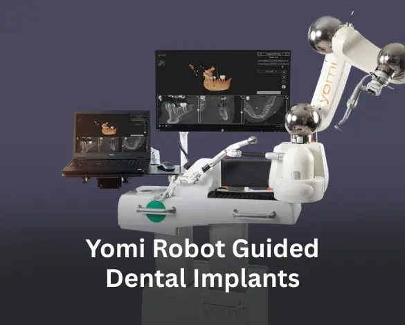 Yomi Robot Guided Dental Implants