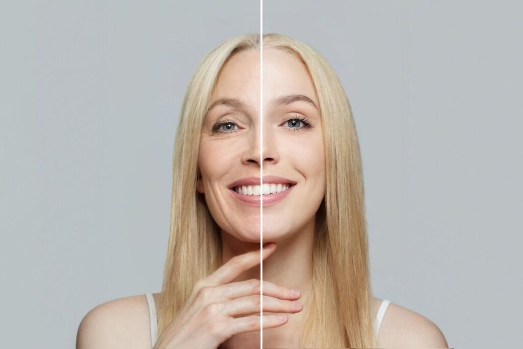 Prevent Premature Facial Aging After Tooth Loss with Professional Implant Care 1 Prevent Premature Facial Aging After Tooth Loss with Professional Implant Care